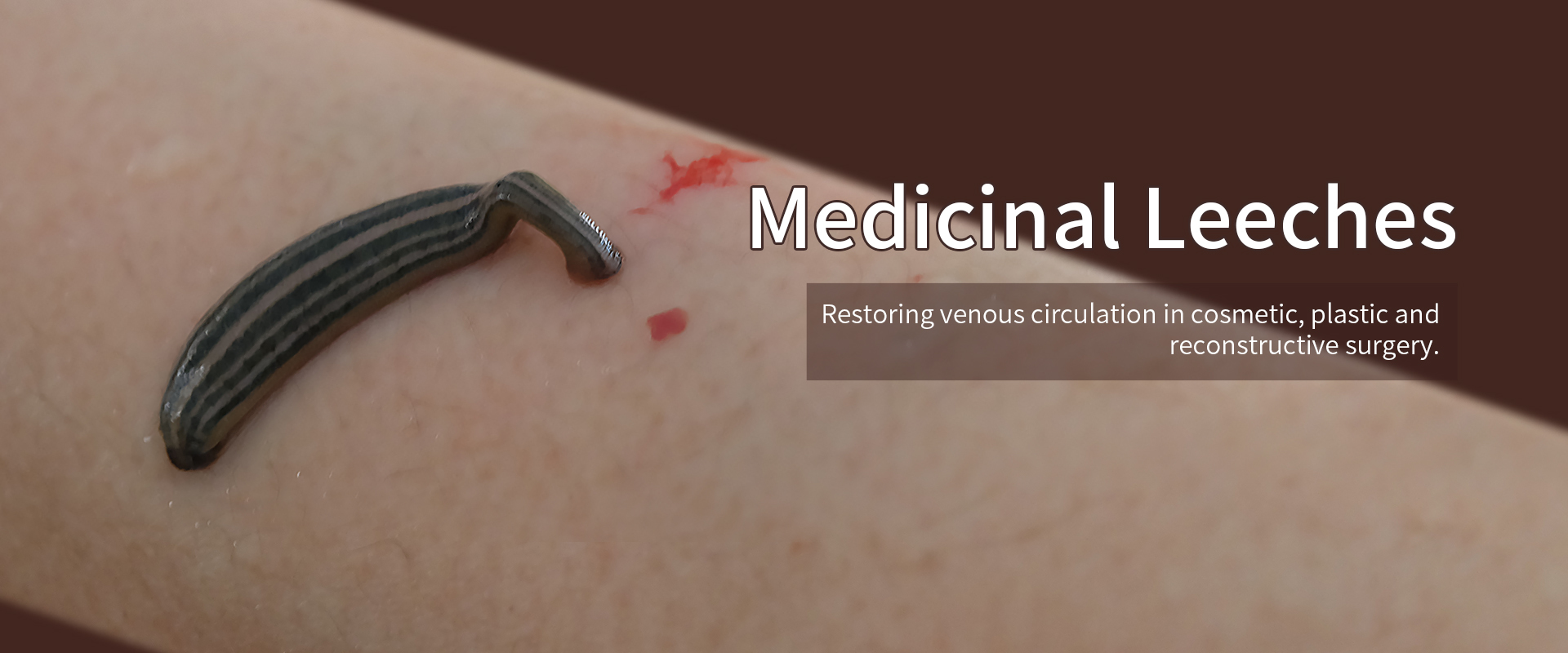 Qualità Sanguisughe medicinali fabbrica